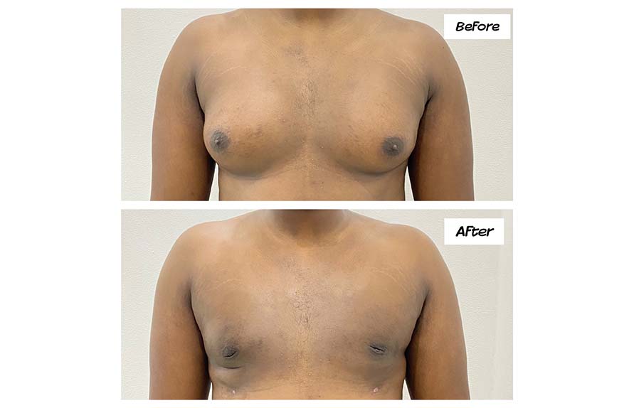 Before - Dr Samir