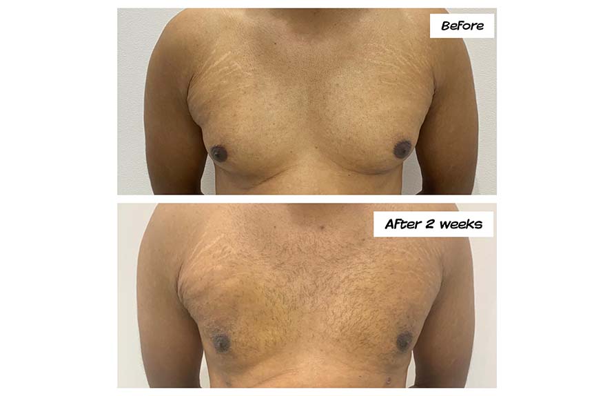 Before - Dr Salim